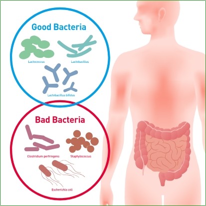 intestinal dysbiosis symptoms